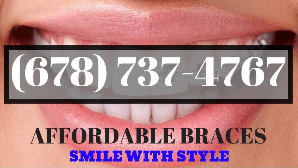 Affordable Braces Atlanta Ga Orthodontic Specialists Dentists