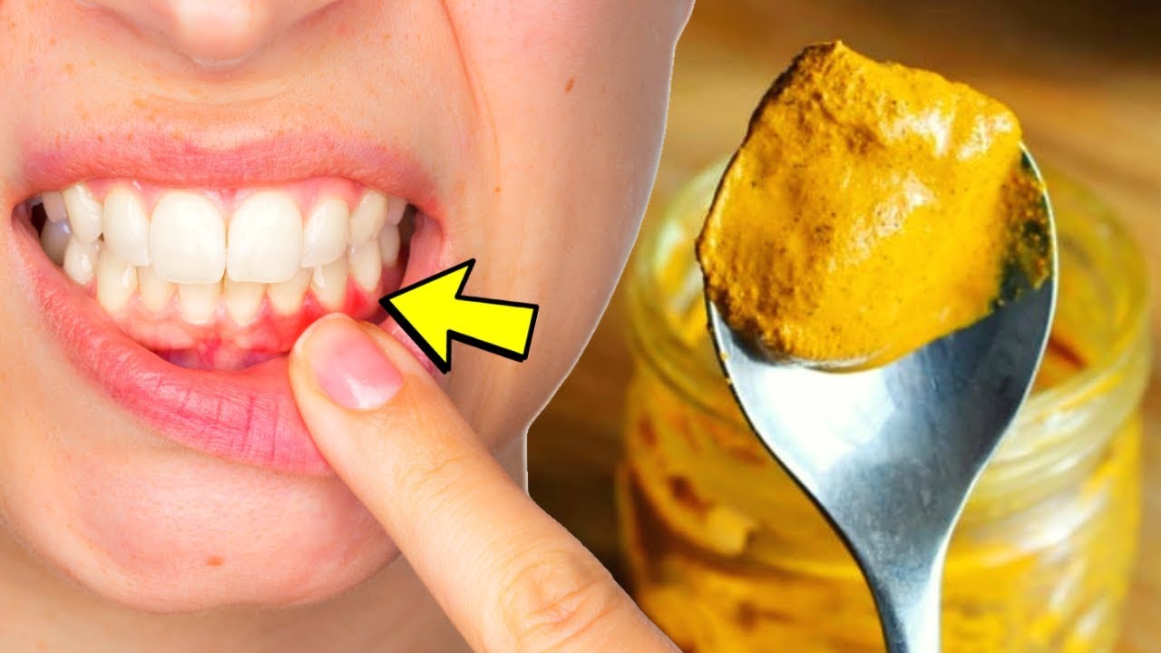 home remedies for tooth infection home remedies for tooth infection